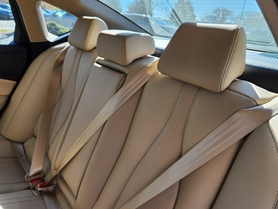 2025 Acura TLX w/Technology Package