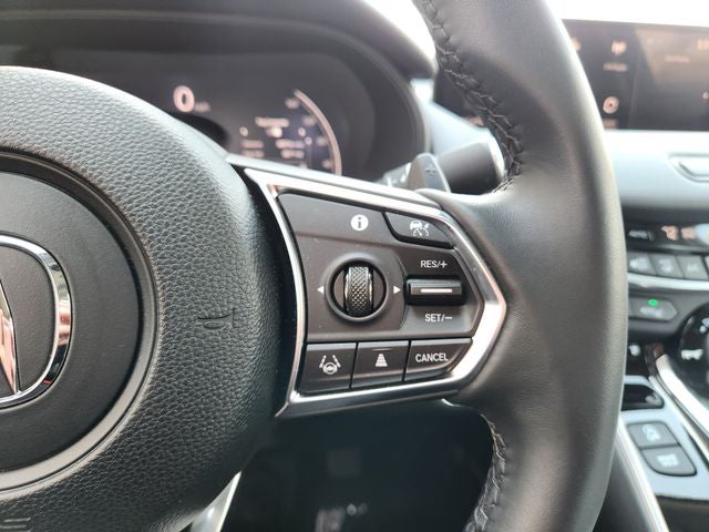 2025 Acura TLX Technology Package