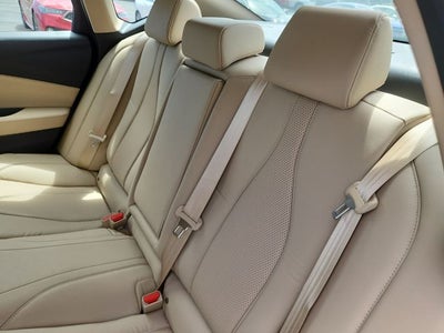 2025 Acura TLX Technology Package