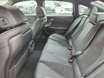 2025 Acura TLX with A-Spec Package