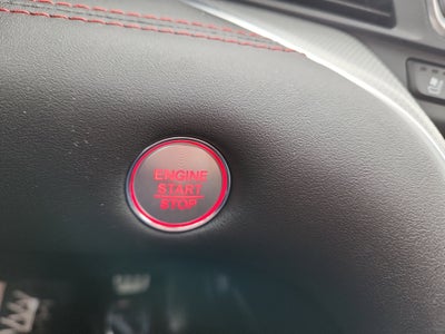 2025 Acura TLX with A-Spec Package