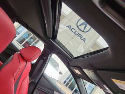 2025 Acura TLX with A-Spec Package